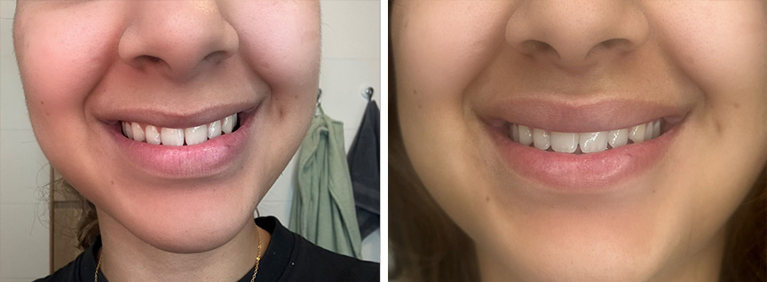lippen dreamclinics